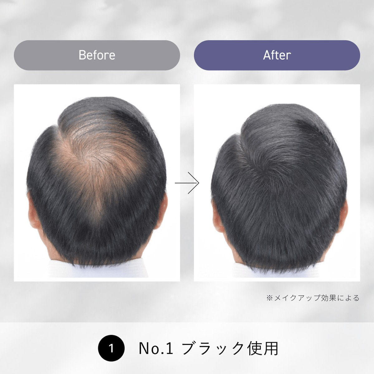 スーパーミリオンヘアー コンパクトセット No1ブラック(10g/15ml)の卸