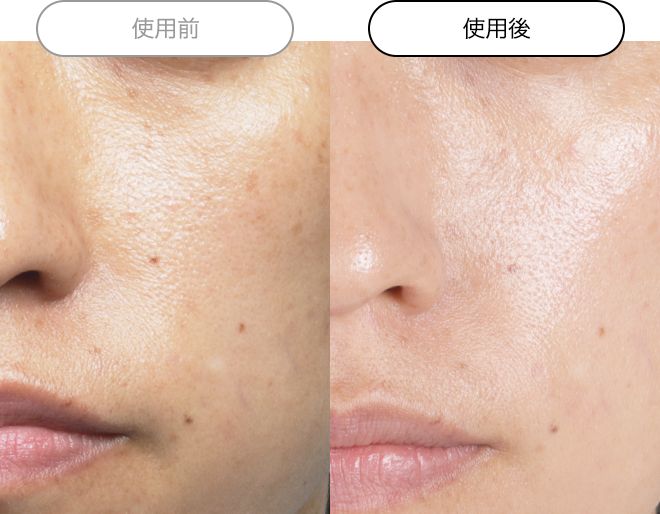 クエスク メディックス EXシリーズ | スキンケア化粧品・サイエンス