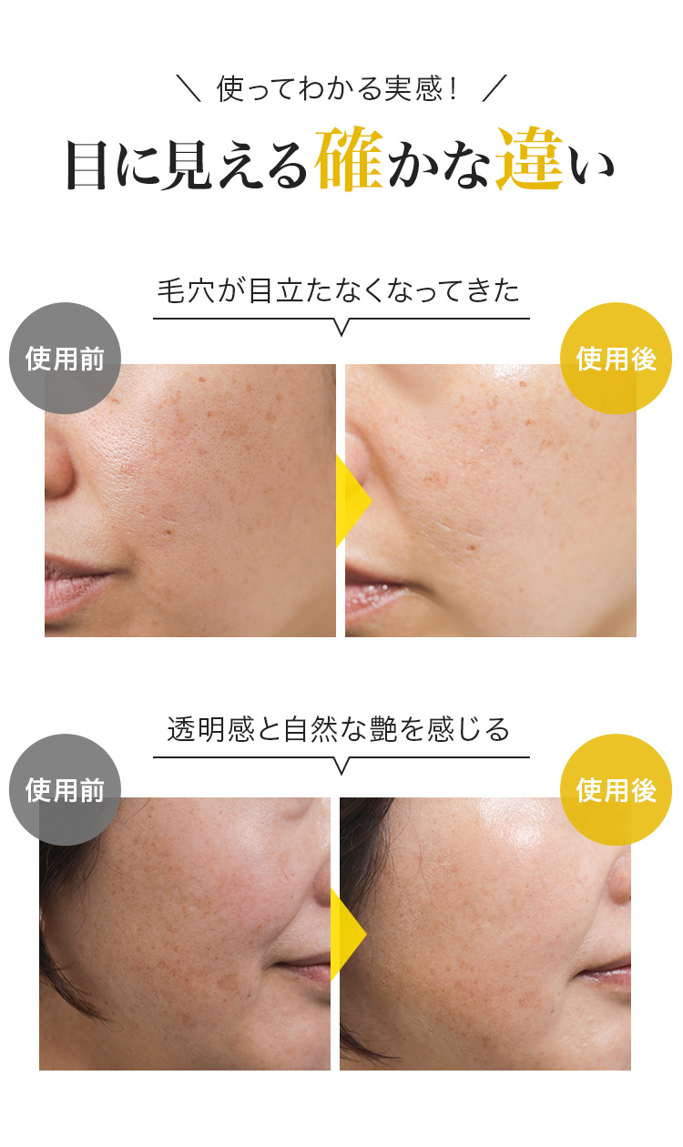 QuSomeレチノA | スキンケア化粧品・サイエンスコスメのビーグレン（b