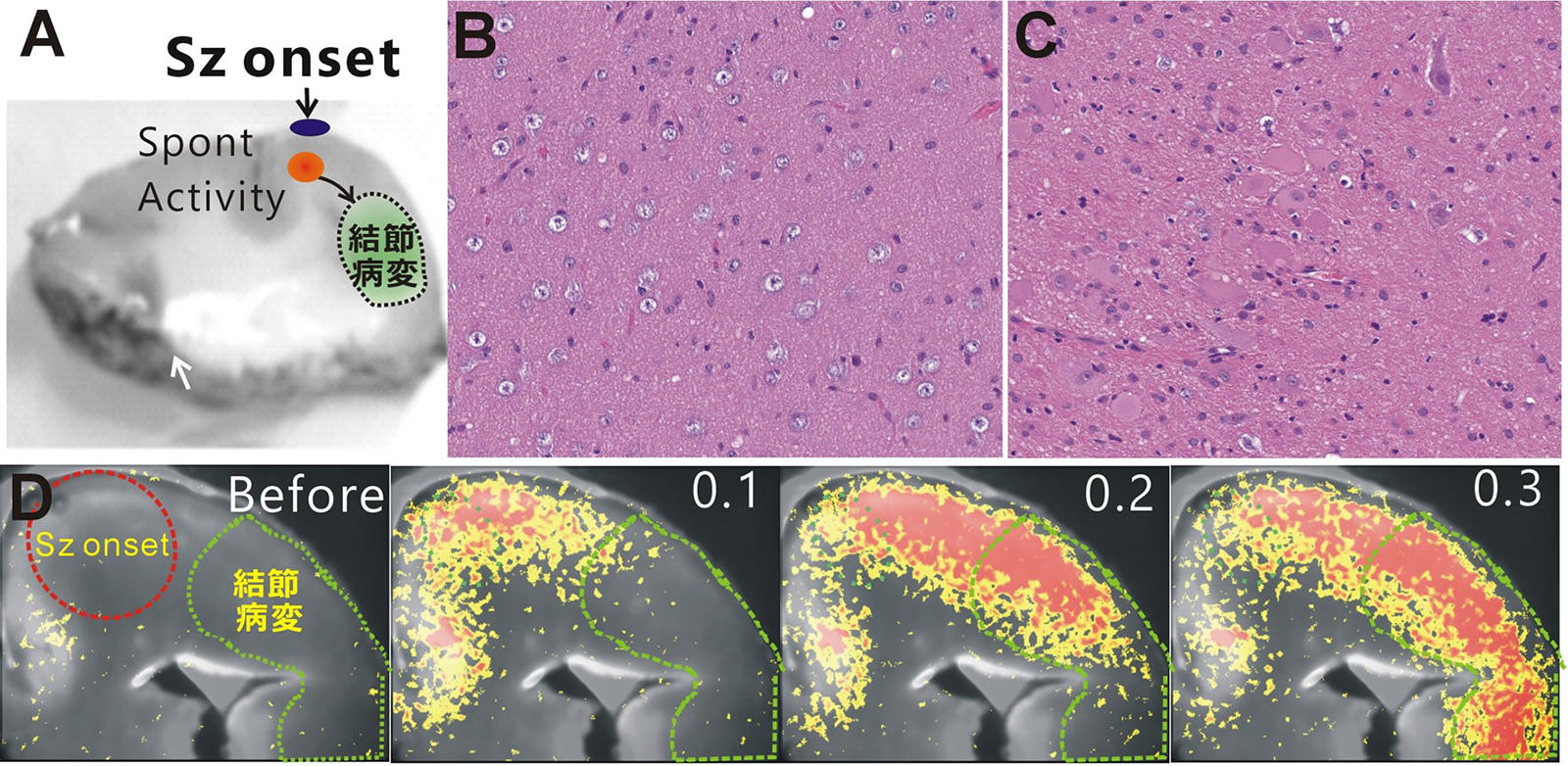 てんかんはどのようにして起こるのか？：機能解析と形態解析の接点