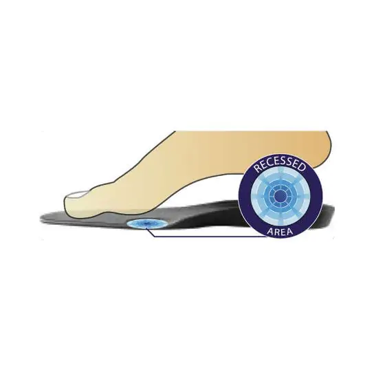 DonJoy Arch Rival Orthotics Inserts | DME-Direct