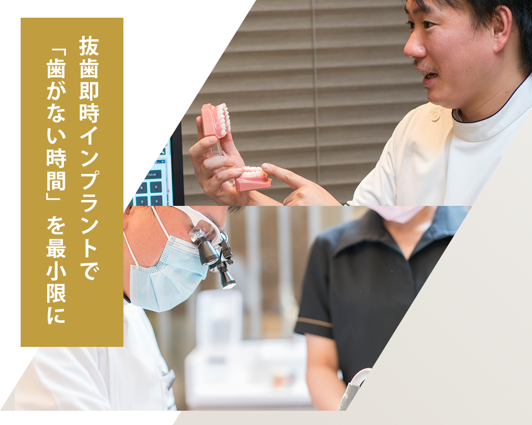 芦屋でインプラントなら中山歯科｜最短3カ月の抜歯即時法、