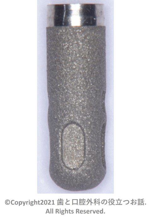 IMZ Implant TwinPlus Cylinder type | 歯と口腔外科の役立つお話