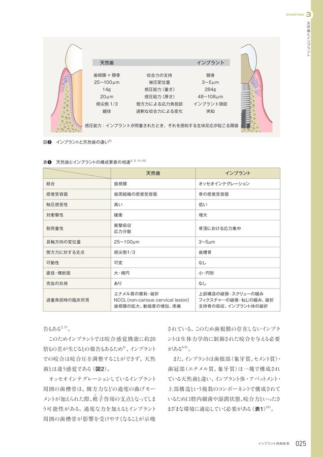 インプラント周囲疾患 診断・予防・対処法