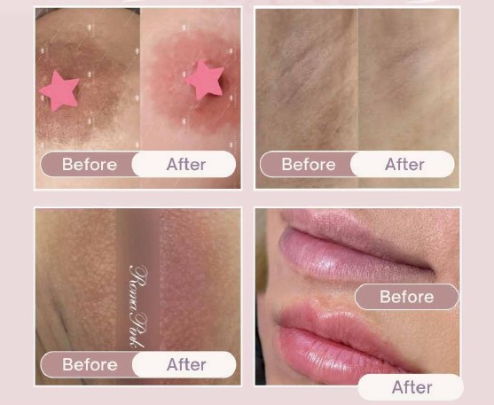 話題の“ローマピンク”って知ってますか？憧れの赤ちゃんピンクへ