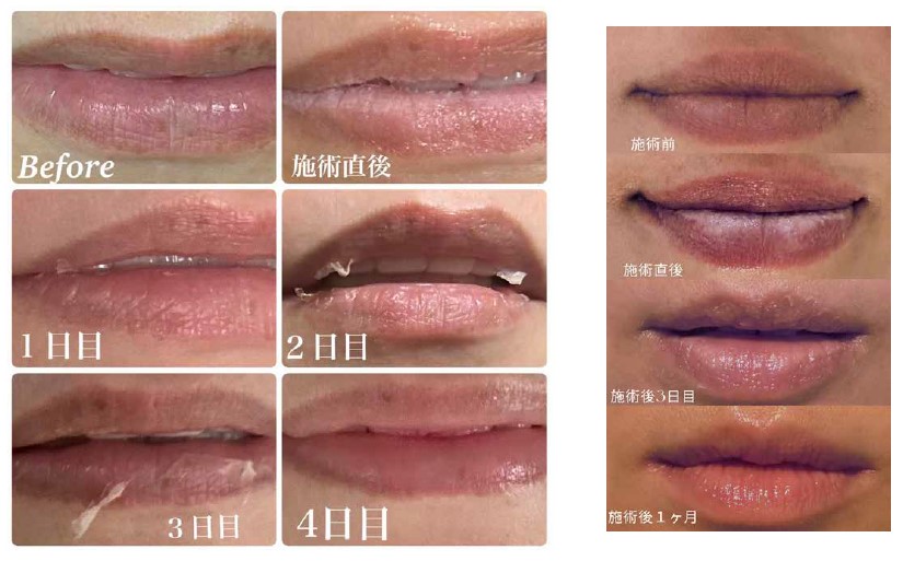 話題の“ローマピンク”って知ってますか？憧れの赤ちゃんピンクへ