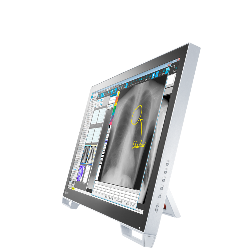 RadiForce MS236WT-A - 23.0