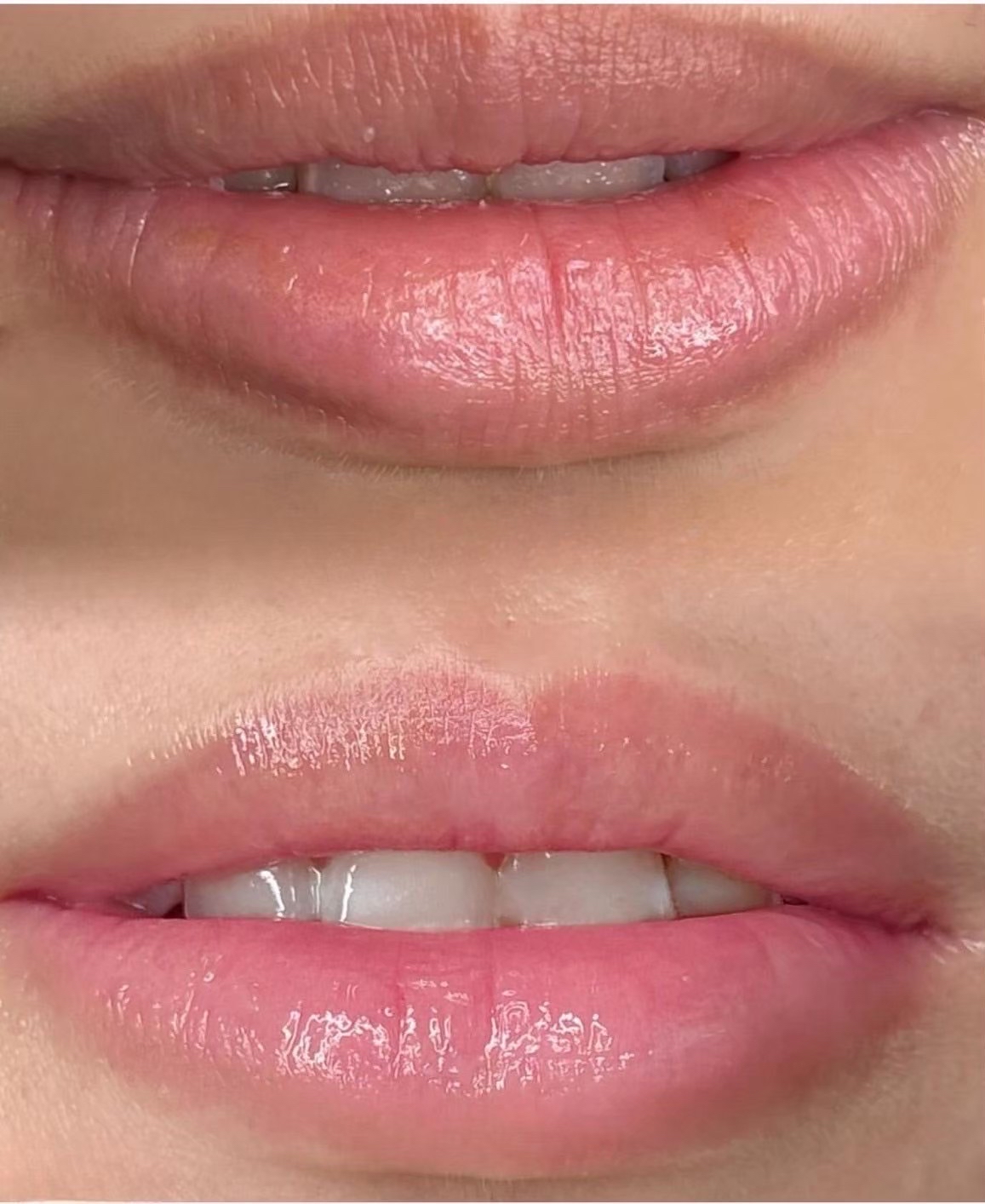 Roma Pink | Elm Clinic Cosmetic Dermatology