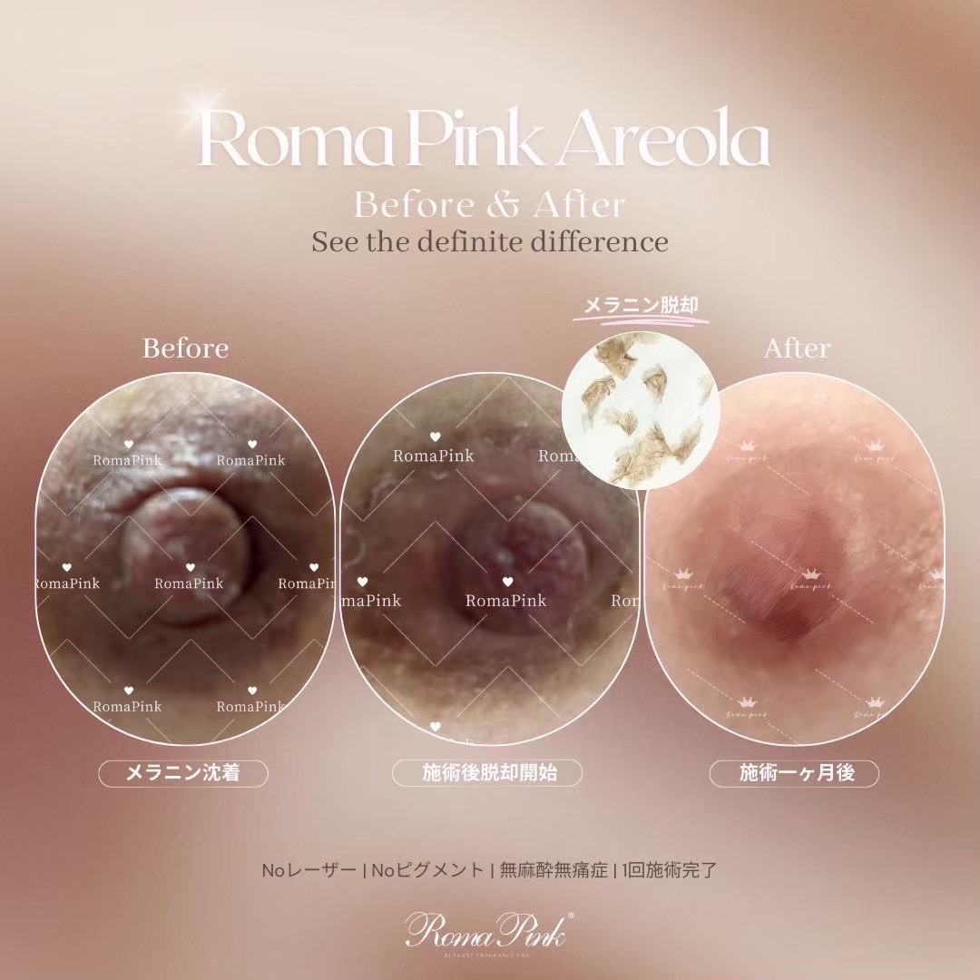 Roma Pink ローマピンク 乳首 アフタークリーム Roma Pink アフター