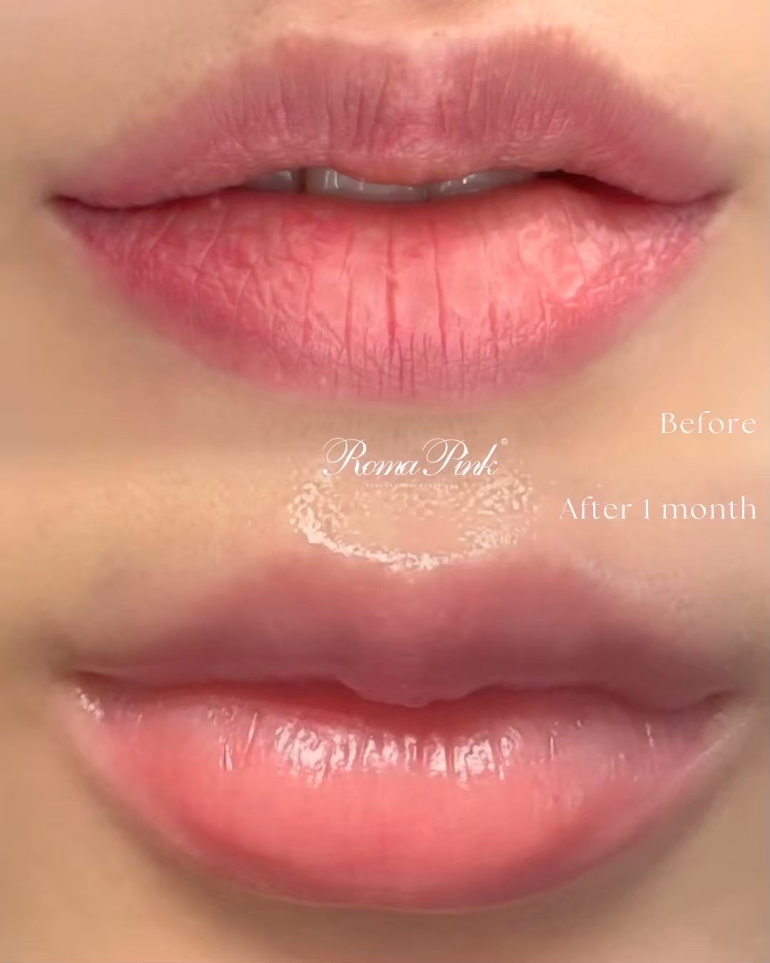 Roma Pink アフタークリーム リップ用 ピンク 3個セット ローマピンク