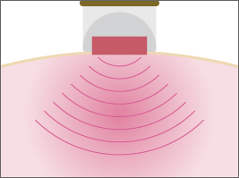 エポックモア｜美しさと健康へ導くマッサージ器 リジューヴェ