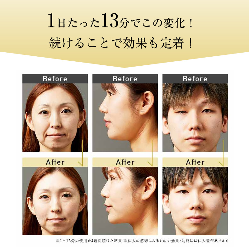 正規販売店】ステラボーテ ビューティ フェイス スティック 2.0 スノー