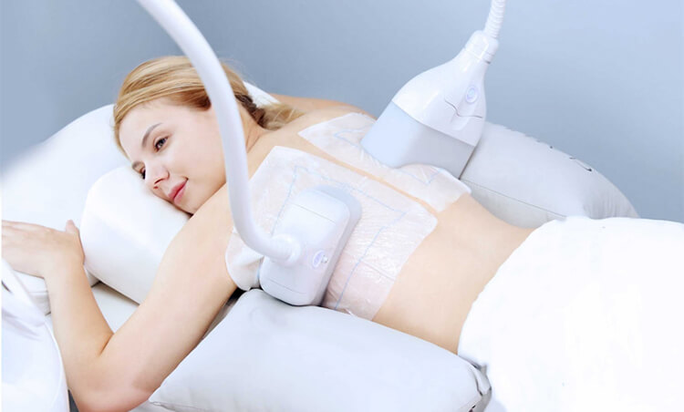 業務用脂肪冷却痩身マシン 3Dサラウンドクライオ – 美容機器 卸の