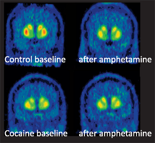 Frontiers | Kappa-Opioid Receptor Signaling in the Striatum as a