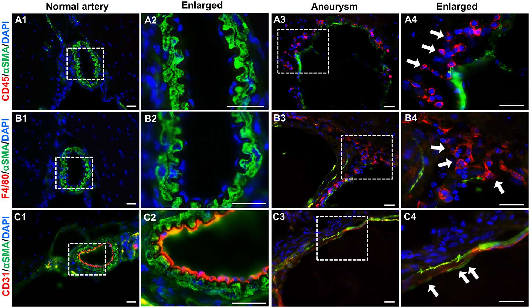 Frontiers | High wall shear stress-dependent podosome formation in