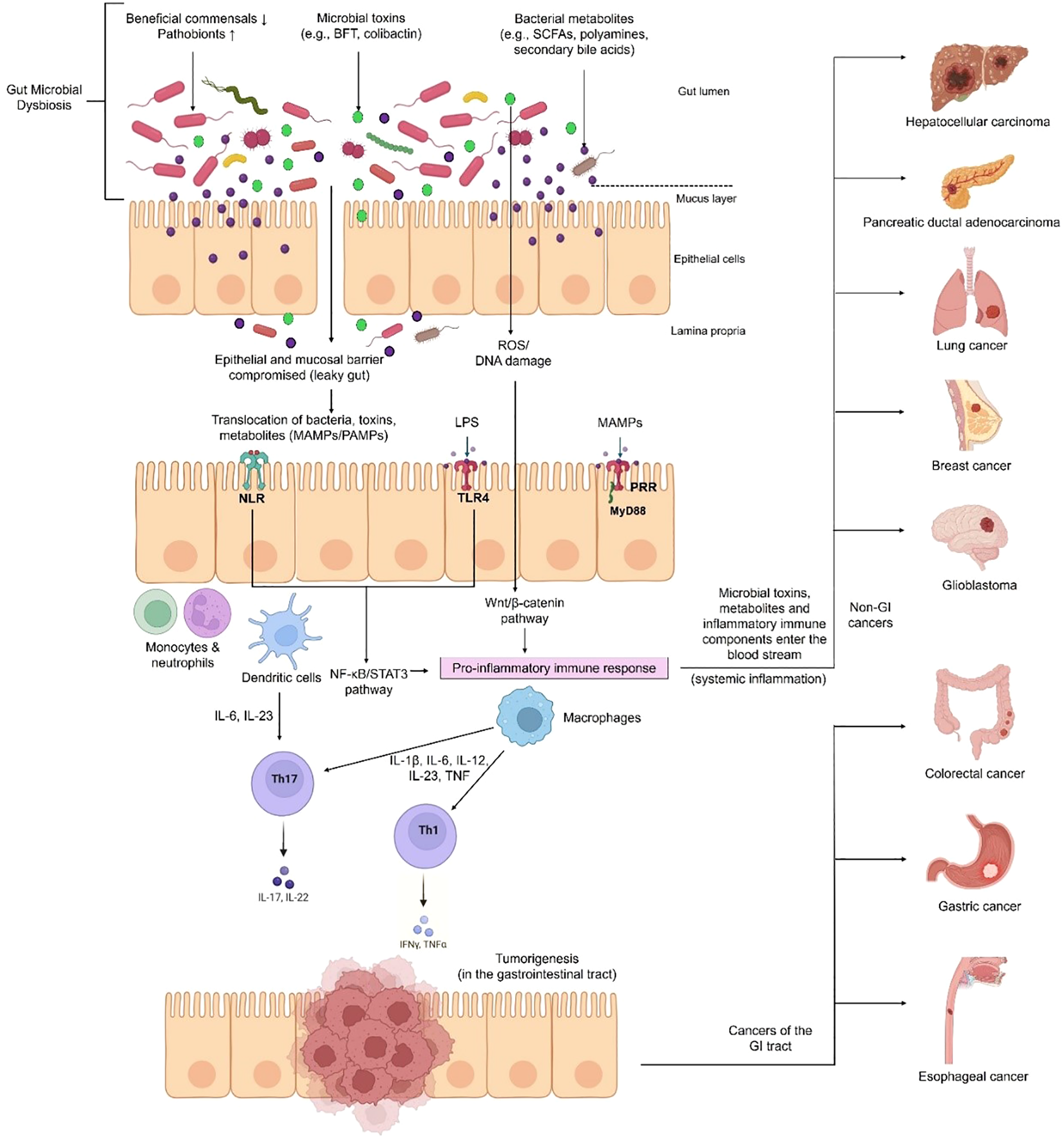 Frontiers | Gut dysbiosis in cancer immunotherapy: microbiota