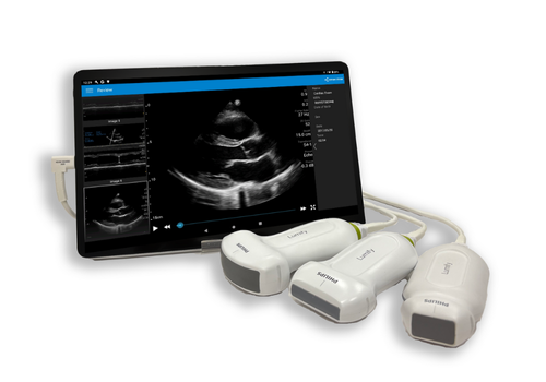 汎用超音波画像診断装置 Versana Active | フクダ電子