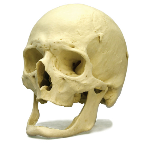 老人頭蓋モデル | 日本スリービー・サイエンティフィック