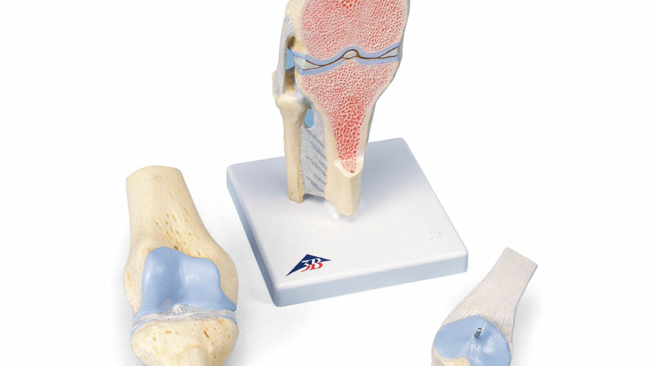 膝の関節断面，3分解モデル | 日本スリービー・サイエンティフィック