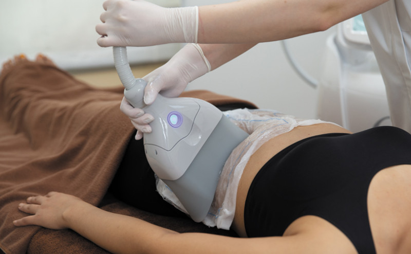 クールスカルプティング（脂肪冷却マシン）で理想的なボディラインを手