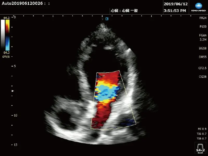 超音波診断装置 SONIMAGE MX1 α | コニカミノルタ