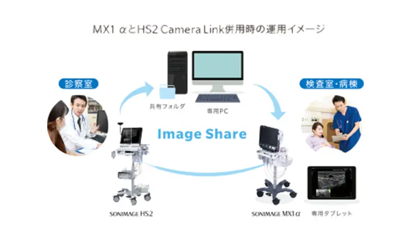 超音波診断装置 SONIMAGE MX1 α | コニカミノルタ