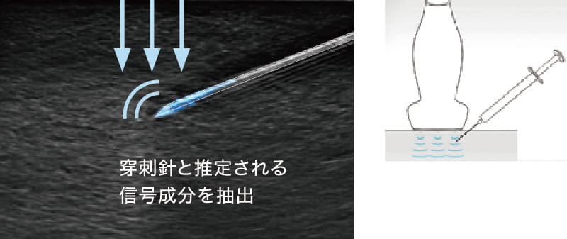 超音波診断装置 SONIMAGE UX1 TRiFOR | コニカミノルタ