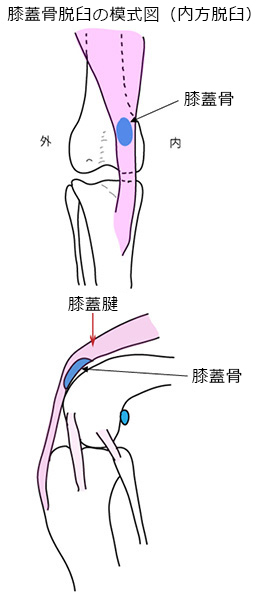 犬の膝蓋骨脱臼 - 経堂の動物病院｜川瀬獣医科病院・川瀬獣医科緑道分院