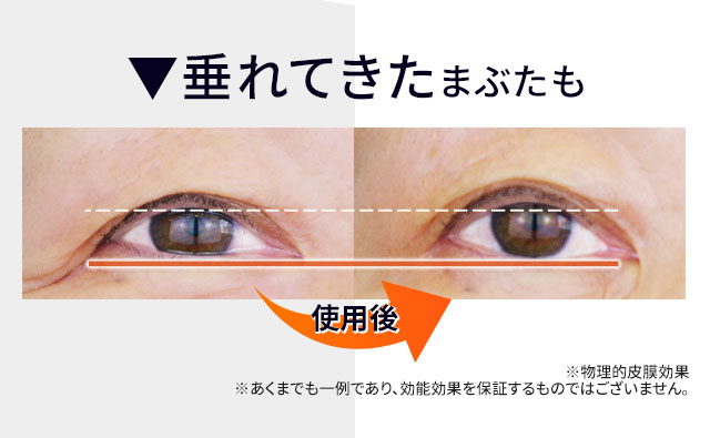 北の快適工房｜『リッドキララ』