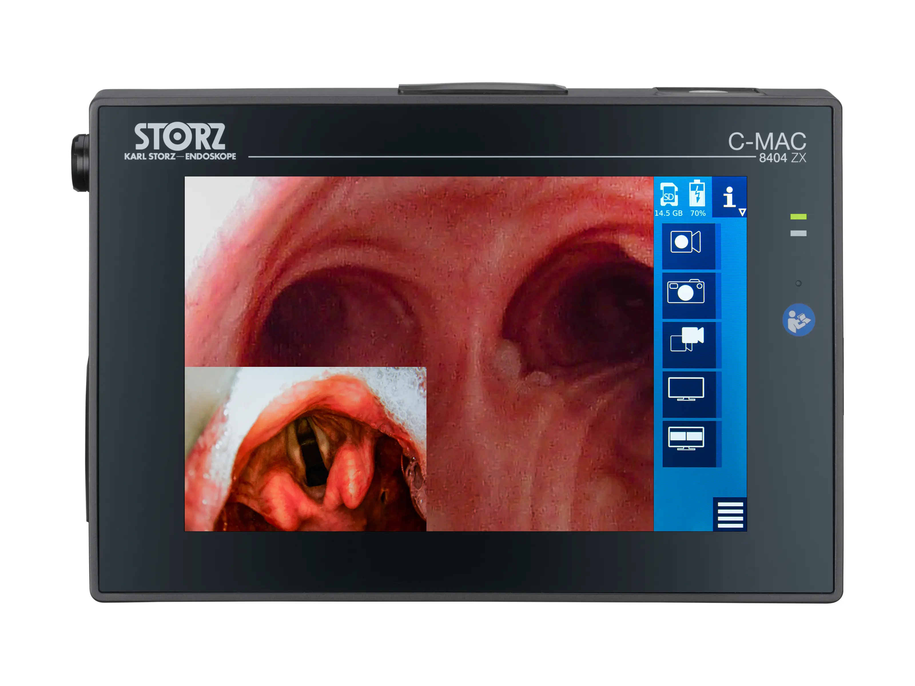 C-MAC Monitor for CMOS Endoscopes, Set | KARL STORZ Endoskope