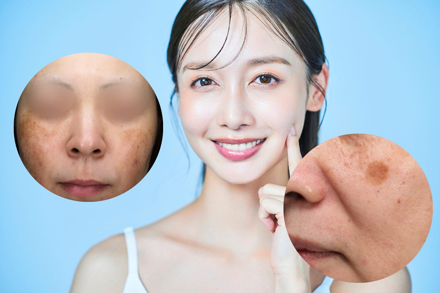 30代のシミはこうして防ぐ！原因と最新の改善法を徹底解説 - ハート