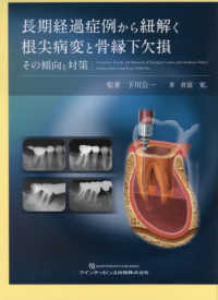 長期経過症例から紐解く根尖病変と骨縁下欠損 / 下川 公一【監著