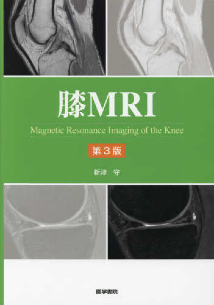 膝MRI / 新津守 - 紀伊國屋書店ウェブストア｜オンライン書店｜本