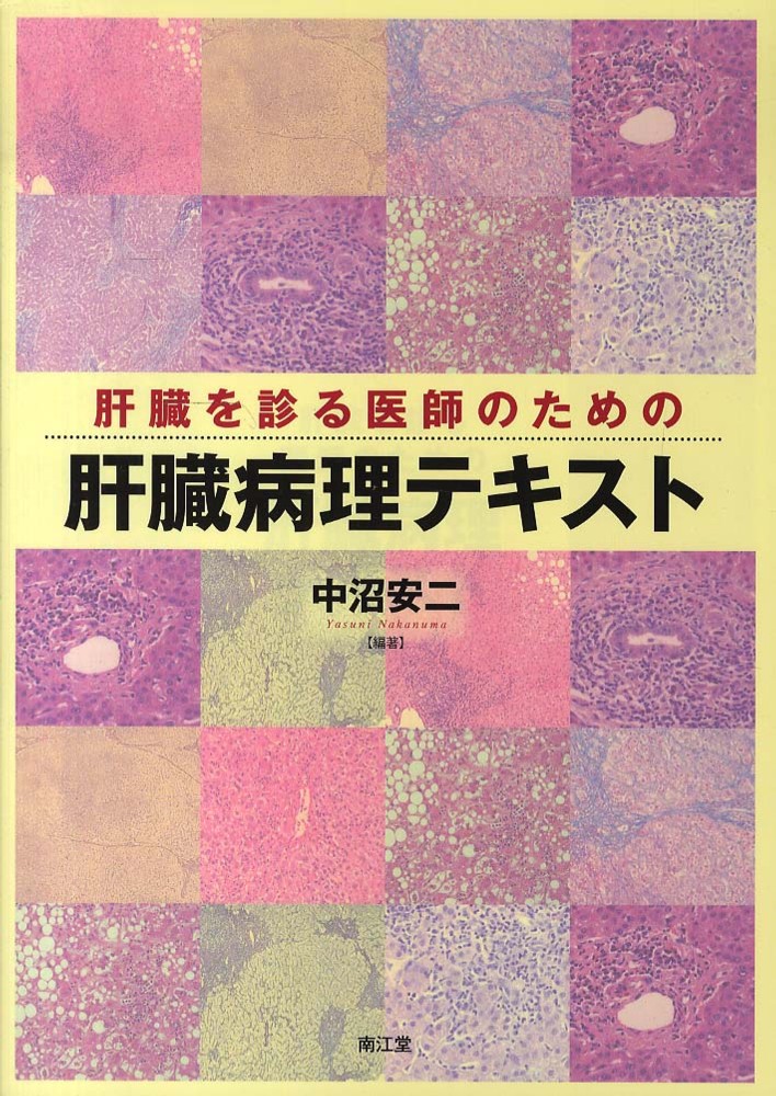 肝臓を診る医師のための肝臓病理テキスト / 中沼 安二【編著