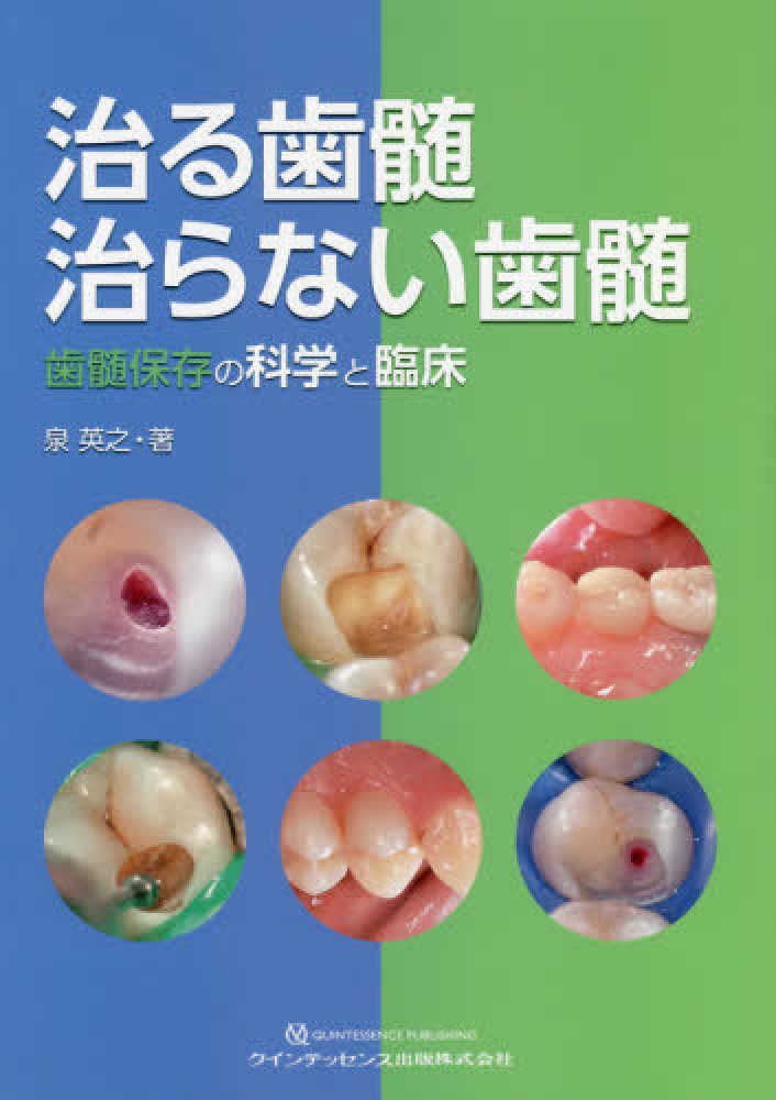 治る歯髄治らない歯髄 / 泉英之 - 紀伊國屋書店ウェブストア