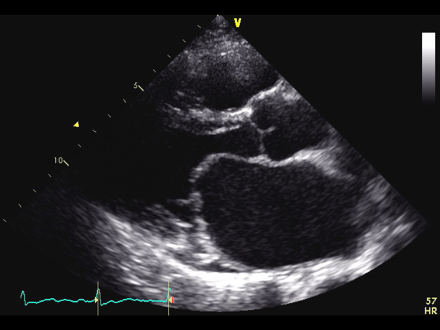 動画を見て学べる！心エコーレポート実例集50｜付録動画