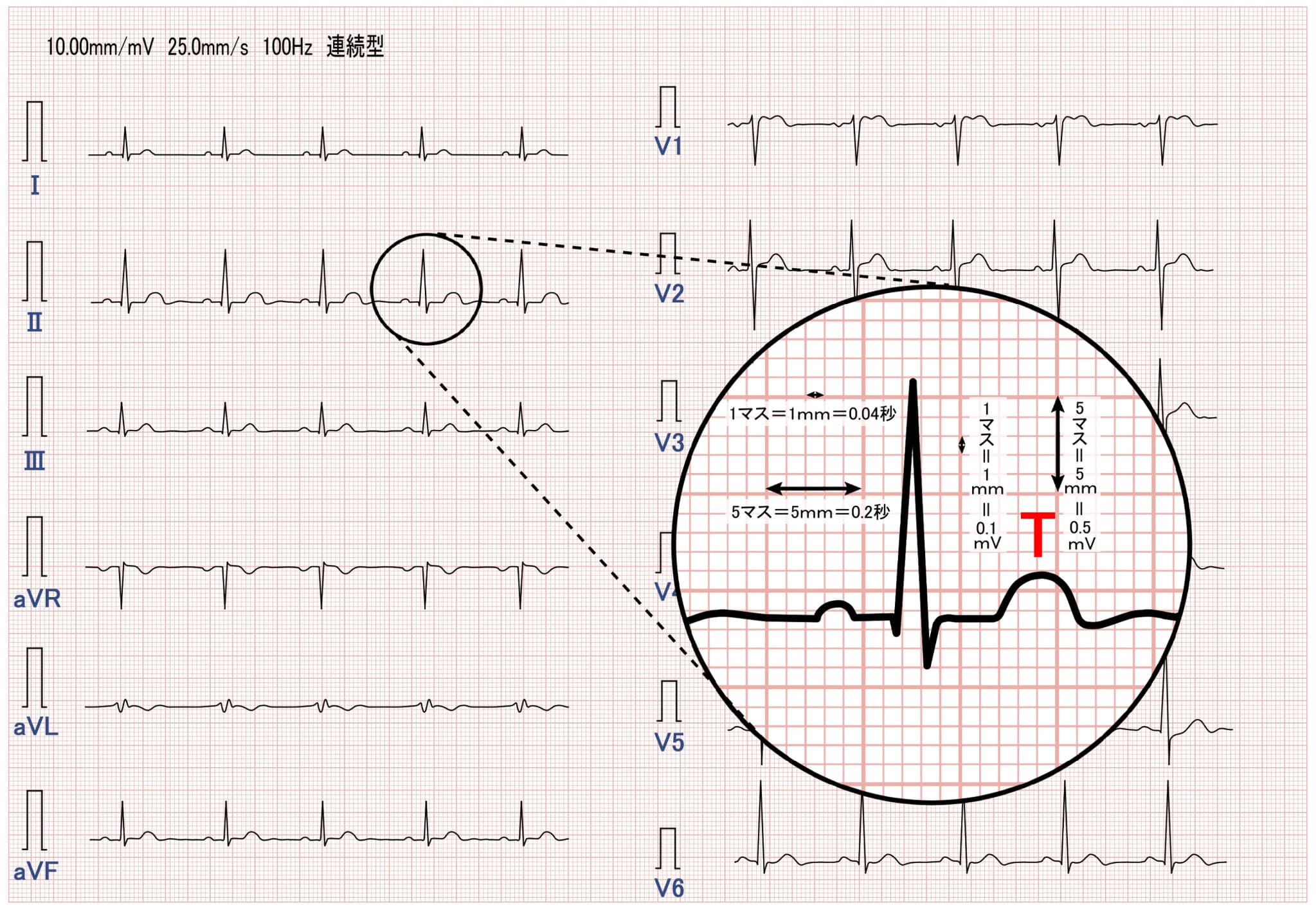 心電図で引っかかる病気は？｜久我山ハートクリニック｜杉並区