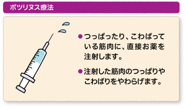 ボツリヌス療法 - 千里中央病院