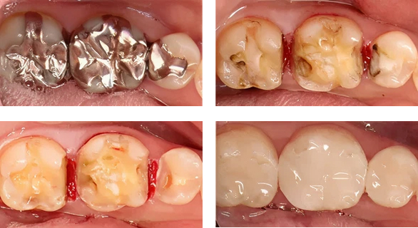 審美治療 | 枚方の歯医者【本多歯科】