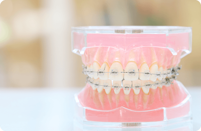 治療中に装置が外れてしまったら・・ - 滋賀県大津市のほりい矯正歯科