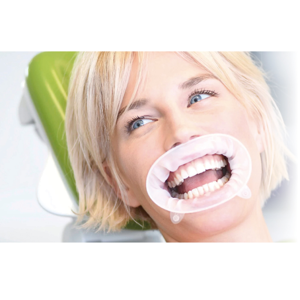 オプトラ ゲート |