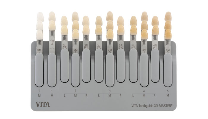 ビタ シェードガイド |