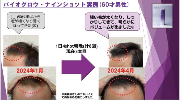 ✨次世代コスメ！再生医療現場から育毛発毛業界へ/頭皮に革命を起こす