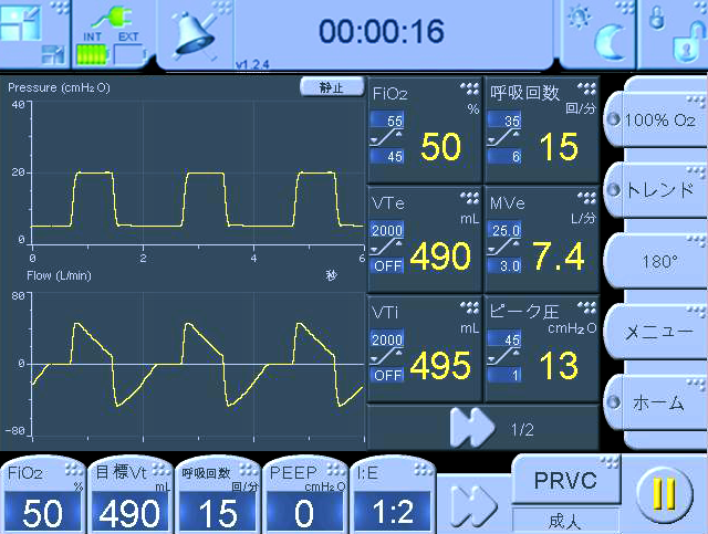 人工呼吸器 MONNAL T60 ベンチレータ 「新機能にズームイン！」｜医療