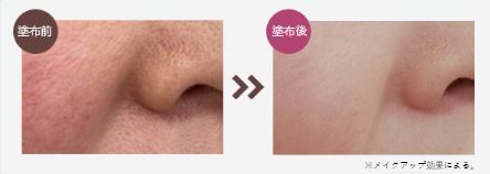 イミニ 公式サイトイミニ 薬用リンクルホワイト 20g(多機能スキンケア