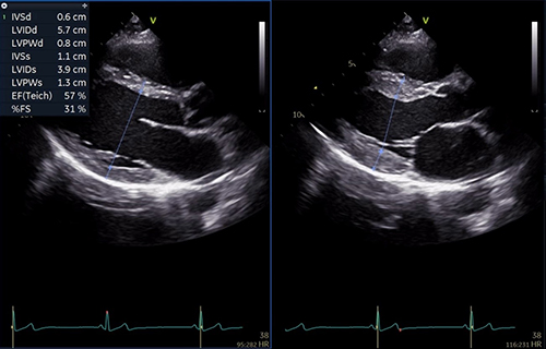 Vivid T9 Ultra Edition（超音波 - 据え置き/循環器，汎用 ）- GE