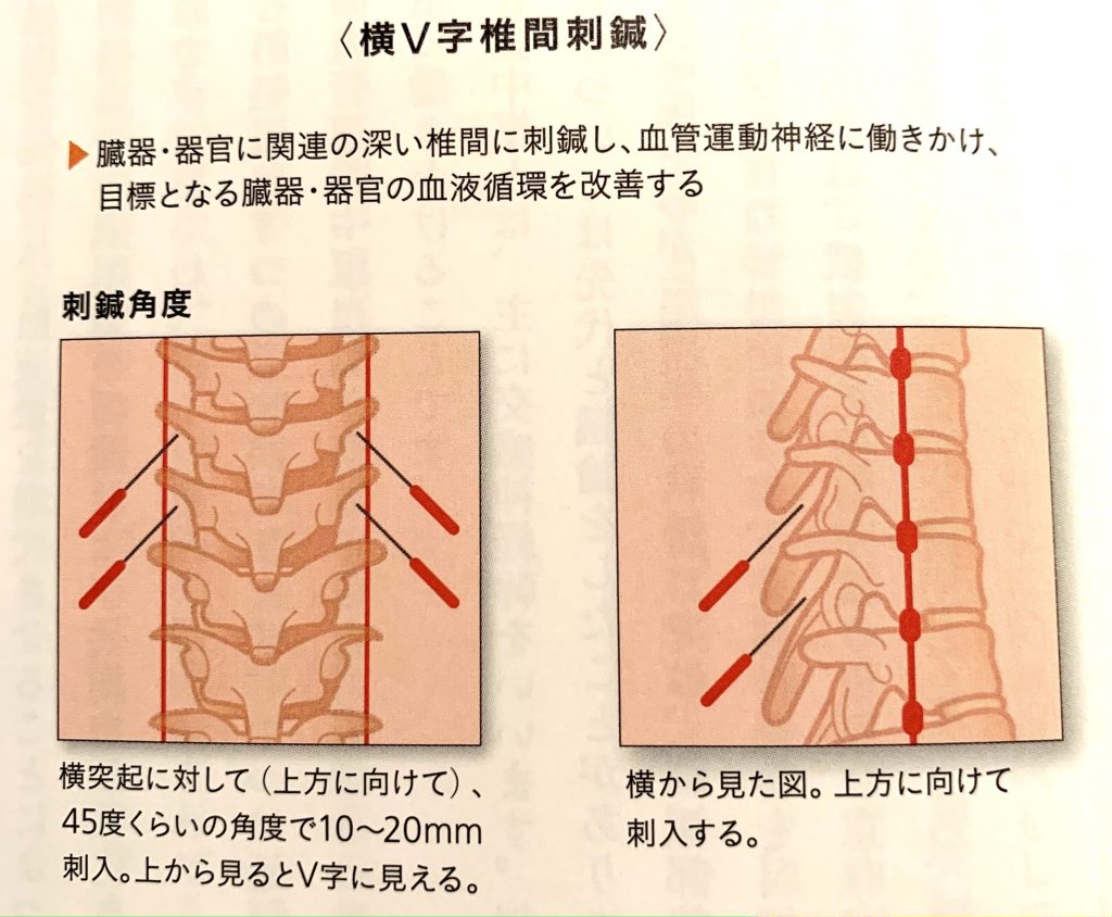 書籍紹介】東西折衷の結果を出せる治療法！「よくわかる長野式治療
