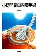 小切開創白内障手術 | 書籍詳細 | 書籍 | 医学書院