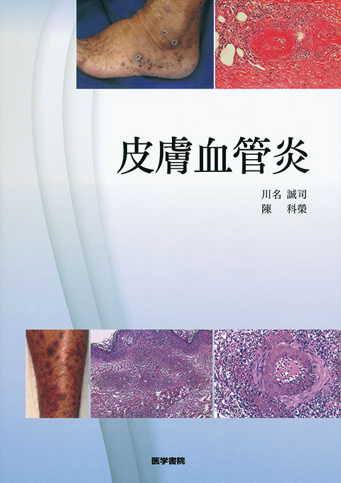 皮膚血管炎 | 書籍詳細 | 書籍 | 医学書院