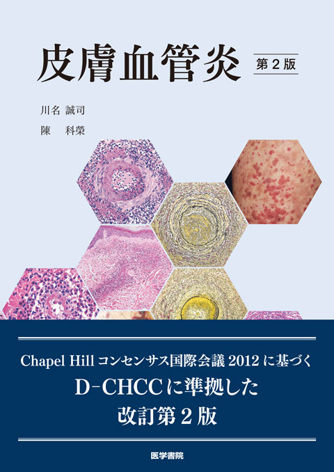皮膚血管炎 第2版 | 書籍詳細 | 書籍 | 医学書院